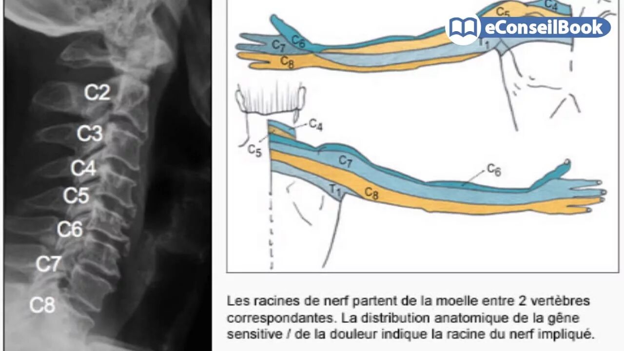 Радикулопатия с6. Радикулопатия с6 с7 корешка. C5-c6 иннервация. 6 И 7 позвонки. Иннервация с5-с7.