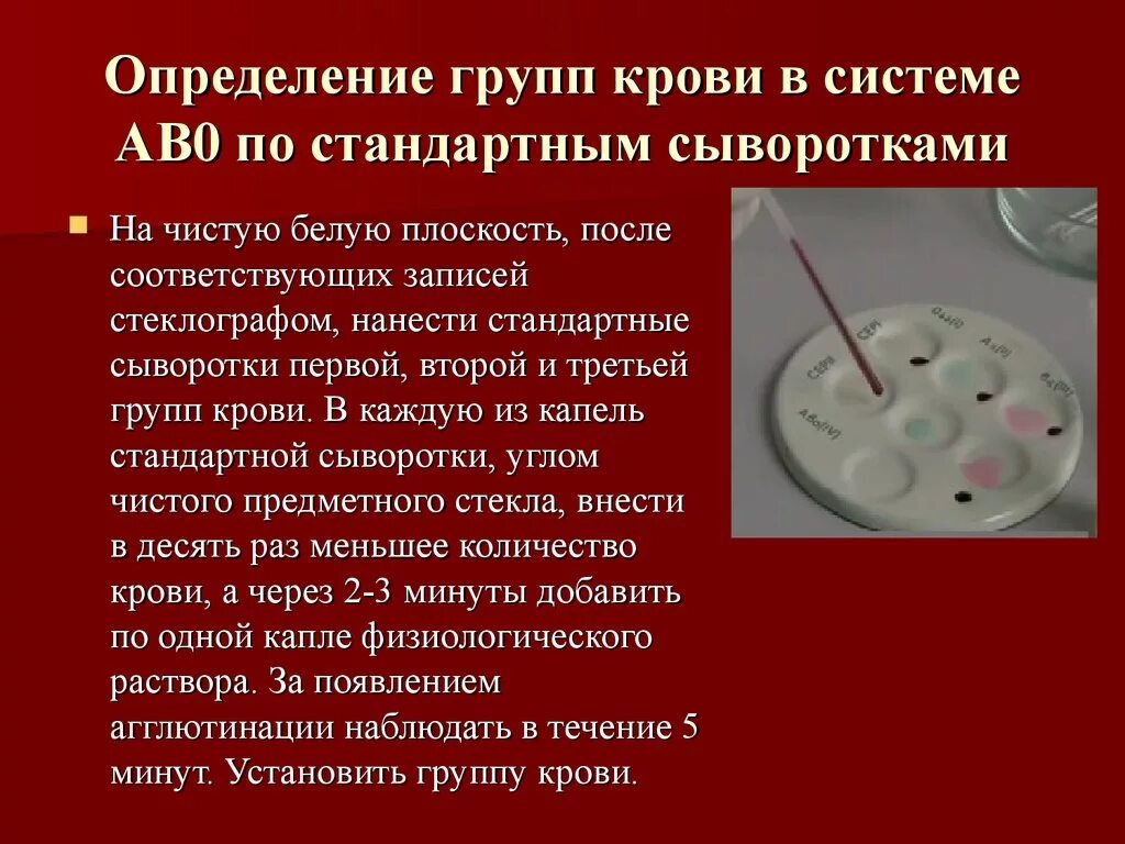 2 группа крови определение. Методики определения групп крови по системе ав0. Определение группы крови методом стандартных сывороток. Методику определения группы крови при помощи стандартных сывороток. Методика определения гр крови.