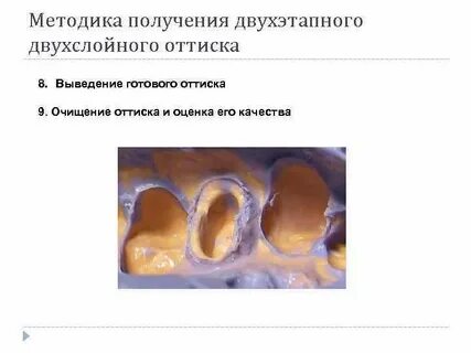 Методы получения оттиска