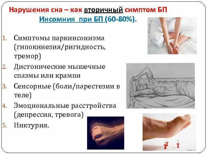 Что такое тремор конечностей