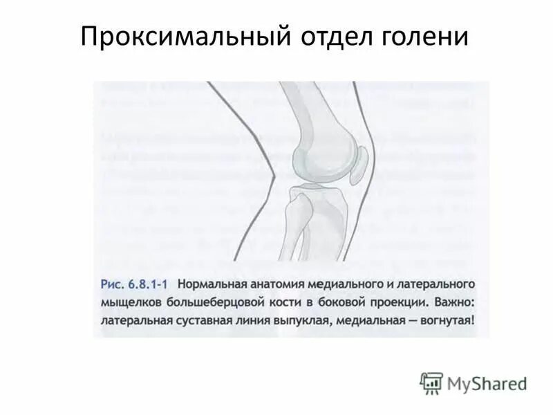 Лучевая кость руки строение. Лучевая кость проксимальный эпифиз. Лучевая кость руки анатомия строение. Внутрикостная анестезия на верхней конечности. Кости голени малоберцовая кость.