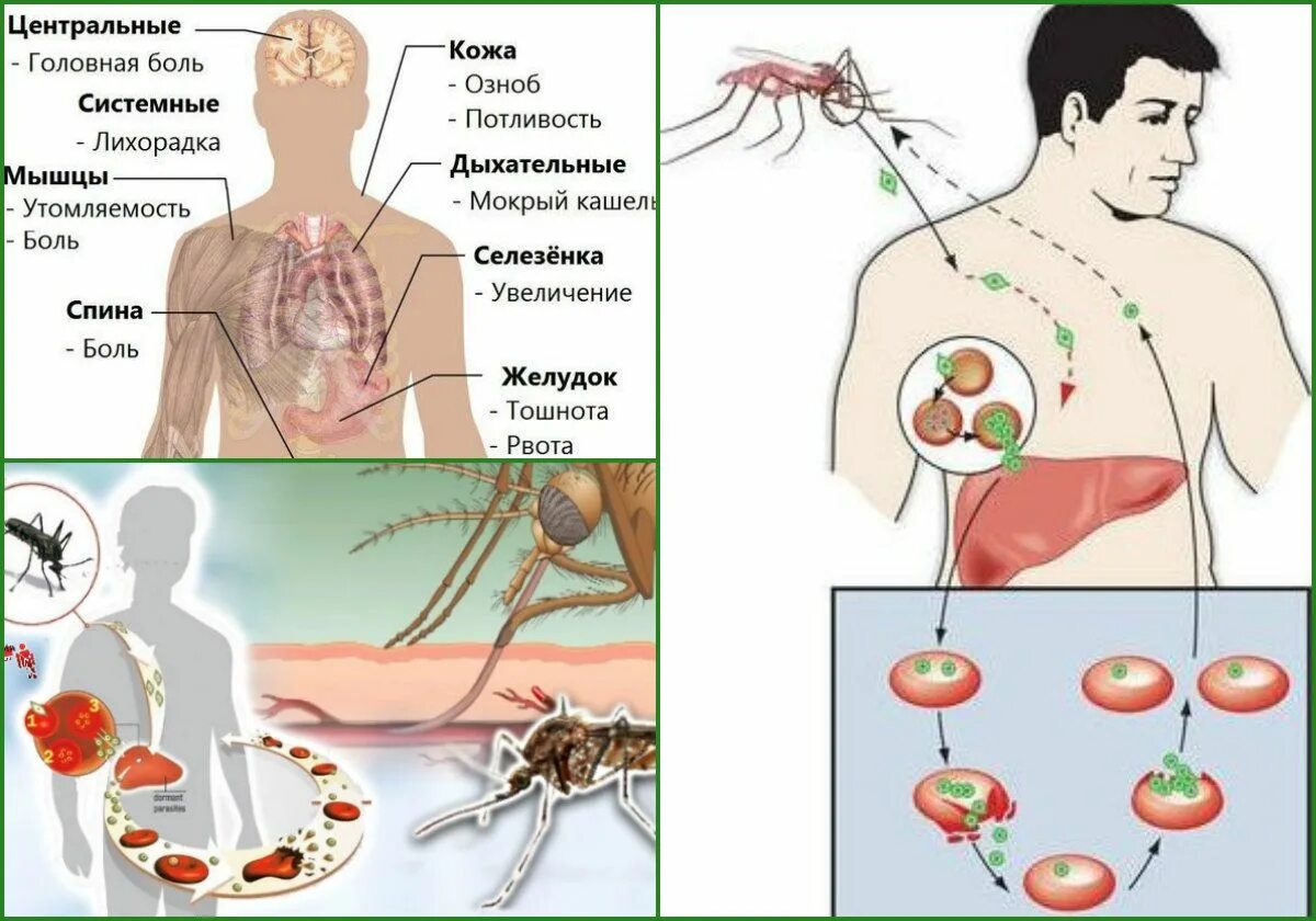 Заболел малярией. Патогенез желтой лихорадки схема. Желтая лихорадка патогенез. Желтая лихорадка пути передачи инфекции.