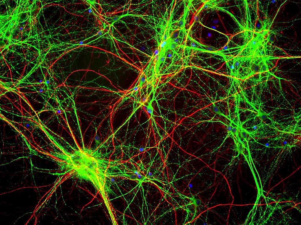Клетки головного мозга. Нейронная сеть. Мозговые Нейроны. Сеть нейронов.