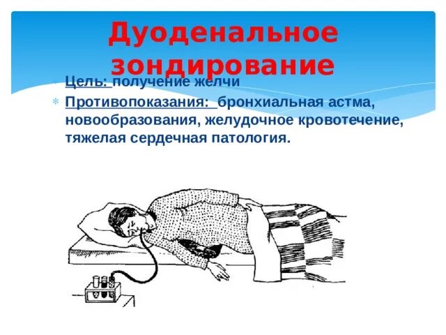 Как происходит зондирование. Цель дуоденального зондирования. слепое зондирование презентация.