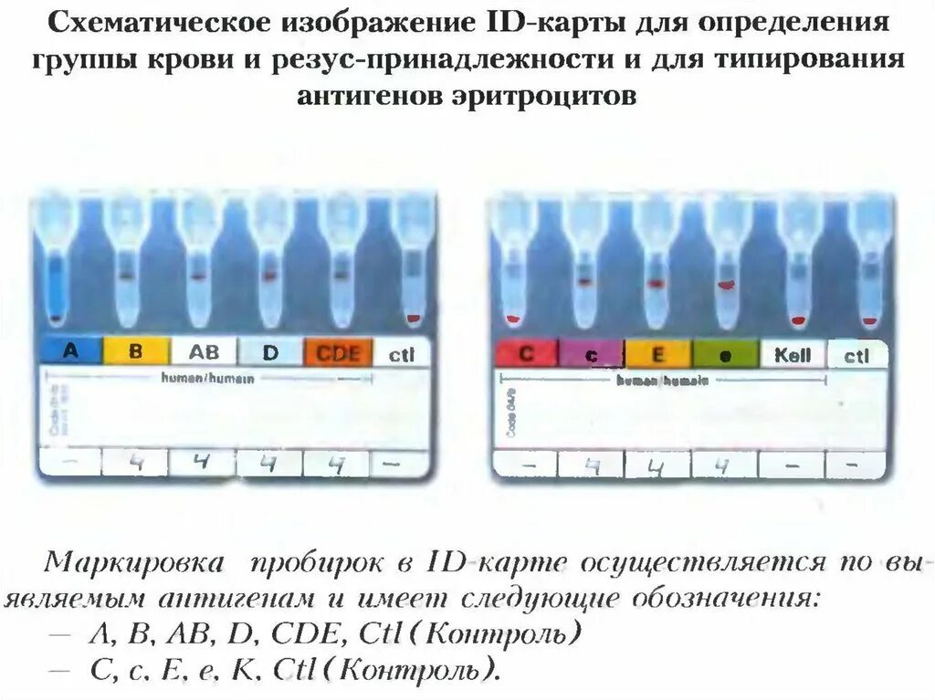 Гелевая методика определения групп крови. Гелевый метод определения группы крови. Карта определения группы крови с резус фактором. Гелевая технология определения группы крови. Занимать в этой группе определенное