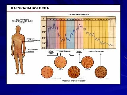 Где распространяется оспа