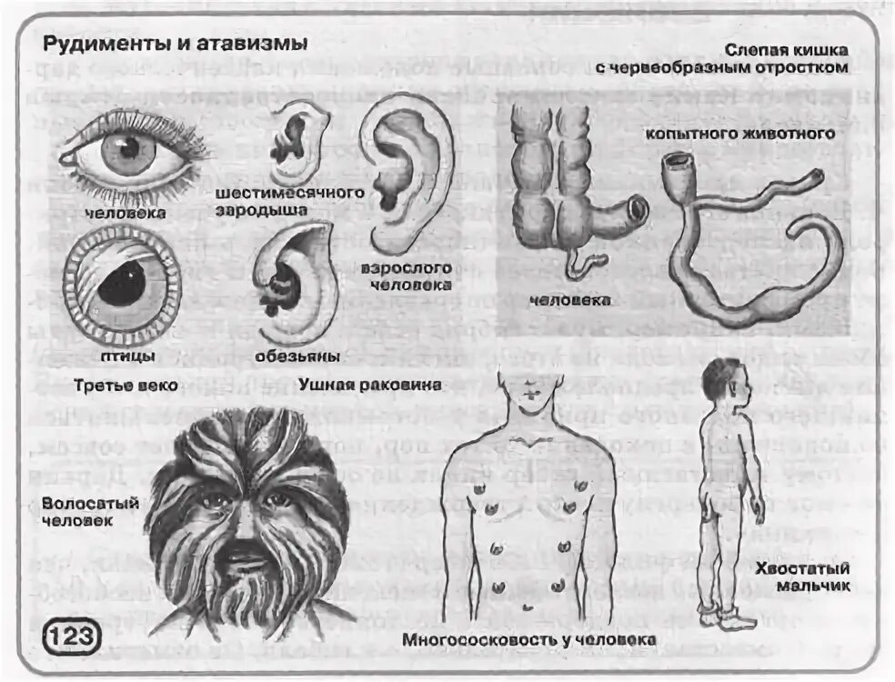 К атавизмам относятся. Атавизмы и рудименты человека. Рудименты и атавизмы человека таблица. Атавизмы и рудименты схема. Атавизмы и рудименты различия.