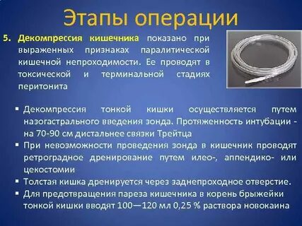 Сколько идет операция на кишечнике