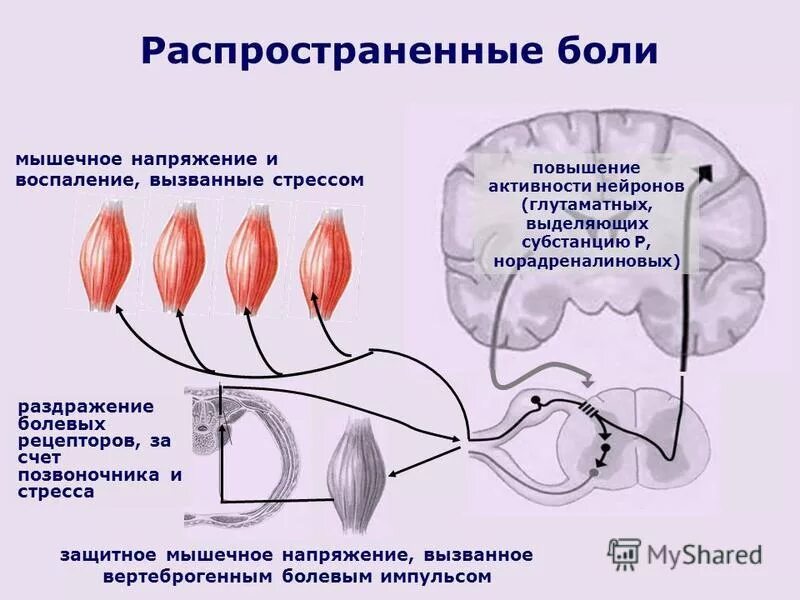 Ощущение возникают при рецепторов. Раздражение рецепторов. Рецепторы боли. Мышечное напряжение. В раздражении болевых рецепторов участвуют.