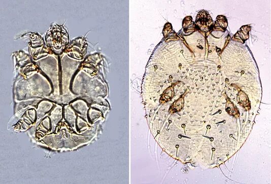 Клещи паразиты таблетки. Sarcoptes scabiei жизненный цикл. Чесоточный паразит Sarcoptes scabiei var. Hominis). Саркоптоз строение клеща.