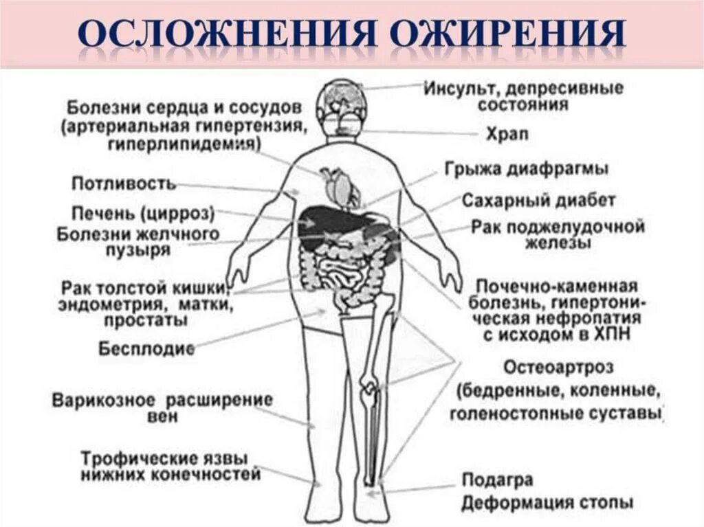 Нарушение питания у ребенка повышает риск развития. Ожирение влияние на организ. факторы риска ожирения. факторы риска при ожирении. факторы риска избыточного веса.
