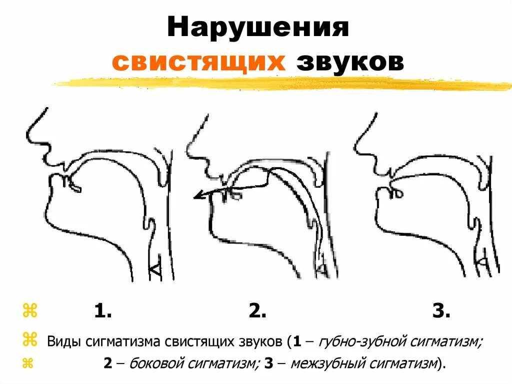 Профили артикуляции свистящих звуков при ринолалии. Нарисуйте профили артикуляции свистящих звуков.. Нарисуйте профили артикуляции свистящих звуков при ринолалии. Профили артикуляции свистящих звуков. С З. З артикуляция