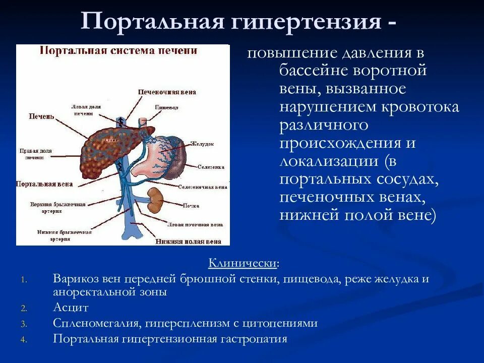 Повышение давления в воротной Вене. Предпеченочная портальная гипертензия. Заболевания при синдроме портальной гипертензии. Повышенное давление в воротной Вене. Тромбоз вены печени