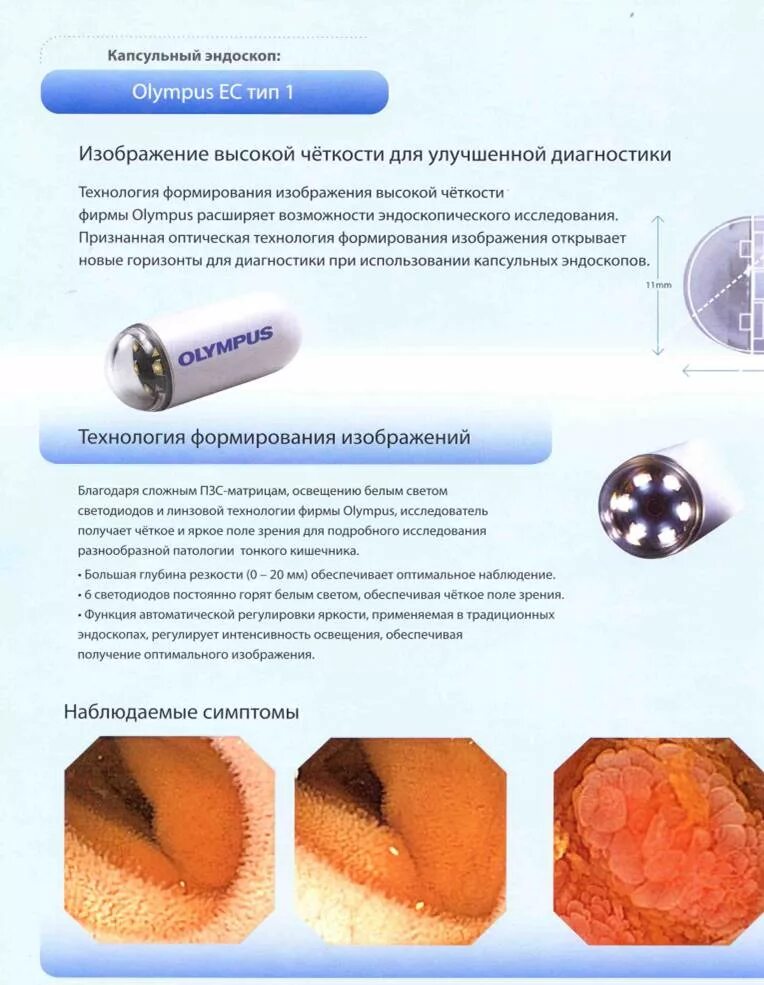 капсульная эндоскопия минск