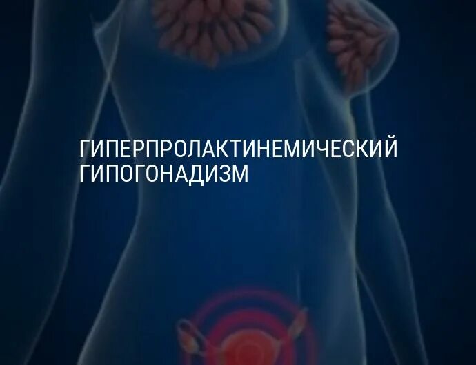 Гипогонадизм у мужчин лечение. Гиперпролактинемический гипогонадизм. Лечение гиперпролактинемического гипогонадизма. Гиперпролактинемический гипогонадизм у женщин. Гипоталамо гипофизарный гипогонадизм.