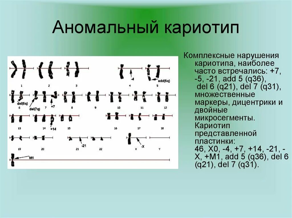 Кариотипирование супругов цена. Кариотип. Кариотип Результаты анализа. Аномальный кариотип. Анализ на кариотип супругов.