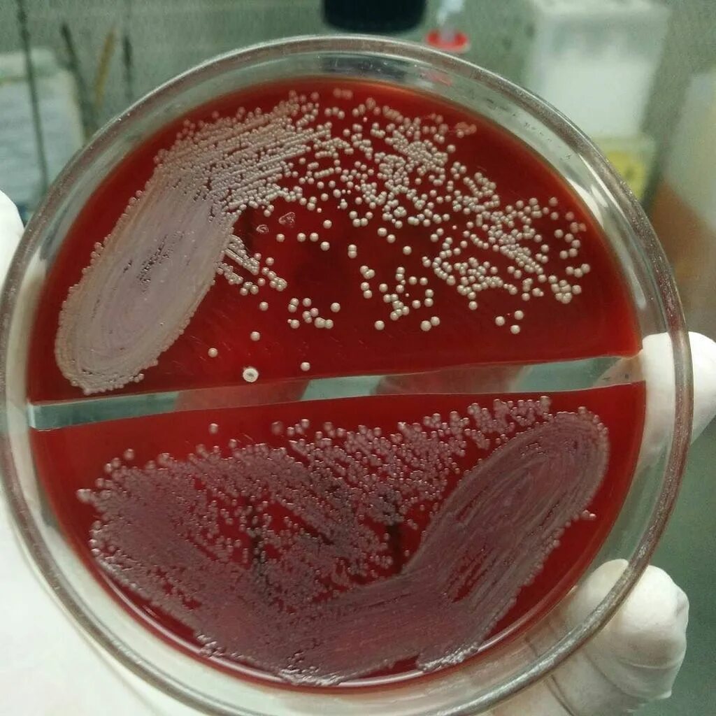 Алая пенистая кровь выделяется при. Trichophyton rubrum чашка Петри. Золотистый стафилококк гемолиз.
