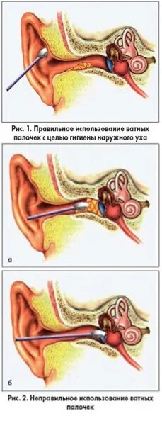 Вата осталась в ухе. Вата осталась в ухе. Вата осталась в ухе. Вата осталась в ухе. Вата осталась в ухе.