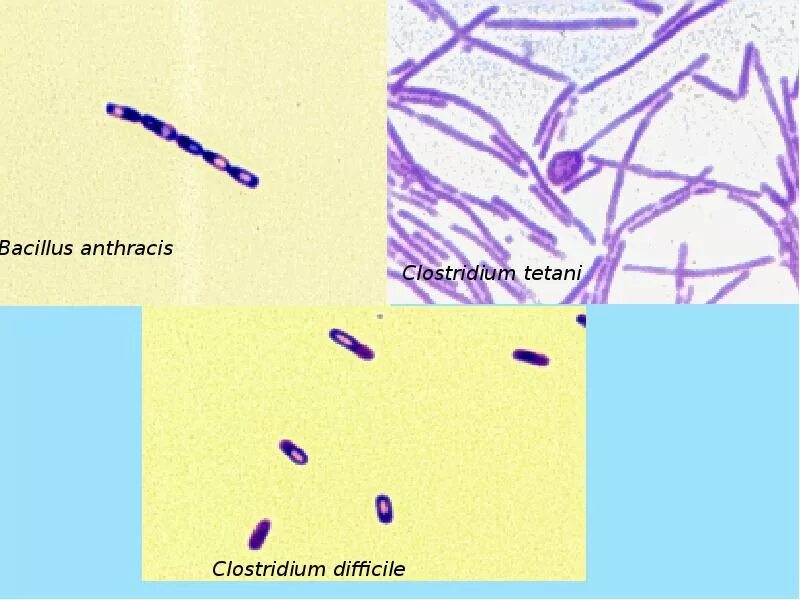 Clostridium difficile что это. Clostridium difficile микробиология. Bacillus anthracis микроскопия. Морфология клостридиум диффициле. Bacillus anthracis микробиология.
