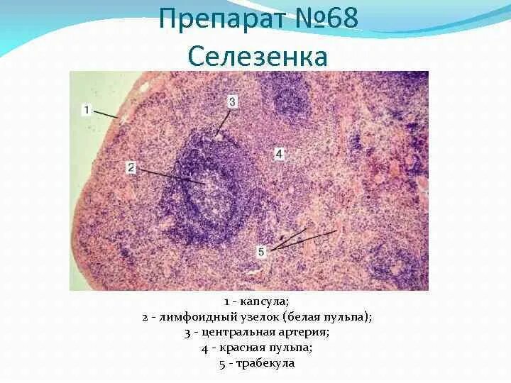 Селезенка препарат гистология. Селезенка гистология препарат. белая пульпа селезенки гистология. строение селезенки гистология. селезенка человека препарат гистология.
