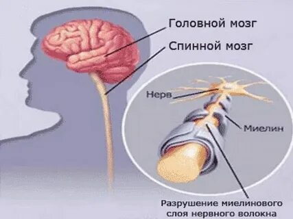 Рассеянный мозг