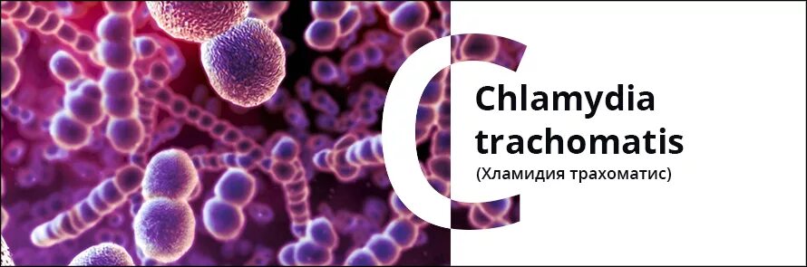 Против хламидий. ПЦР диагностика хламидиоза. ДНК Chlamydia trachomatis. Хламидии трахоматис ПЦР.