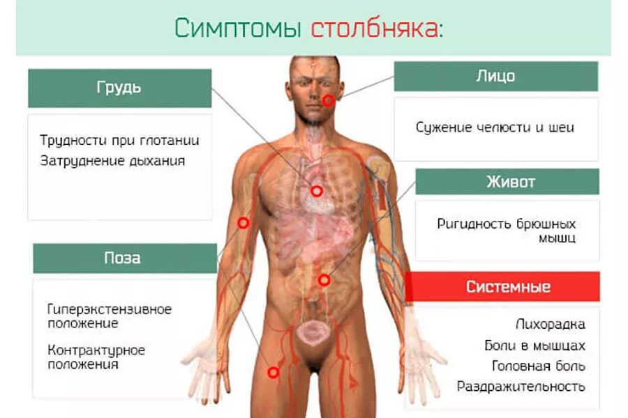 Сколько нельзя мочить столбняк. Основные симптомы столбняка. Симптомы заражения столбняком. Ранние симптомы столбняка. Клинические симптомы столбняка у человека.