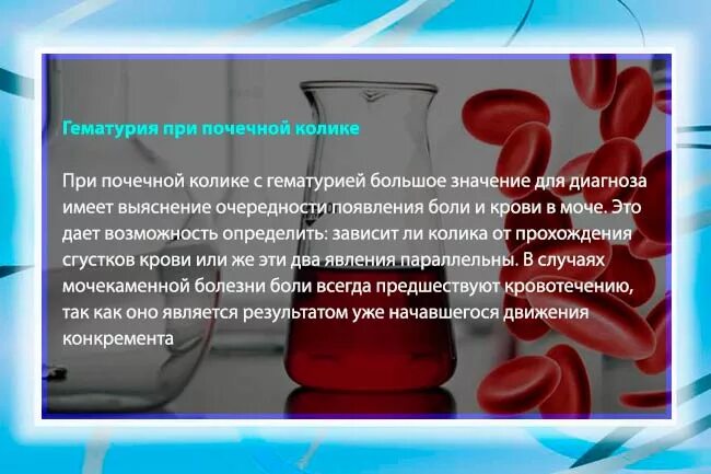 Гематурия это появление. Микрогематурия при почечной колике. почечная колика гематурия. гематурия при почечной колике. микрогематурия при посечной колики.