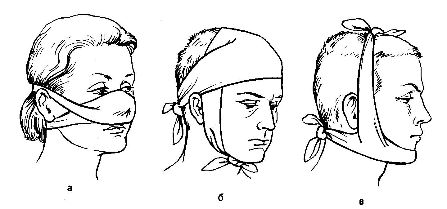 Нос затылок. Наложение пращевидной повязки. Пращевидная повязка на нос и подбородок. Техника наложения пращевидной повязки. Десмургия пращевидная повязка.