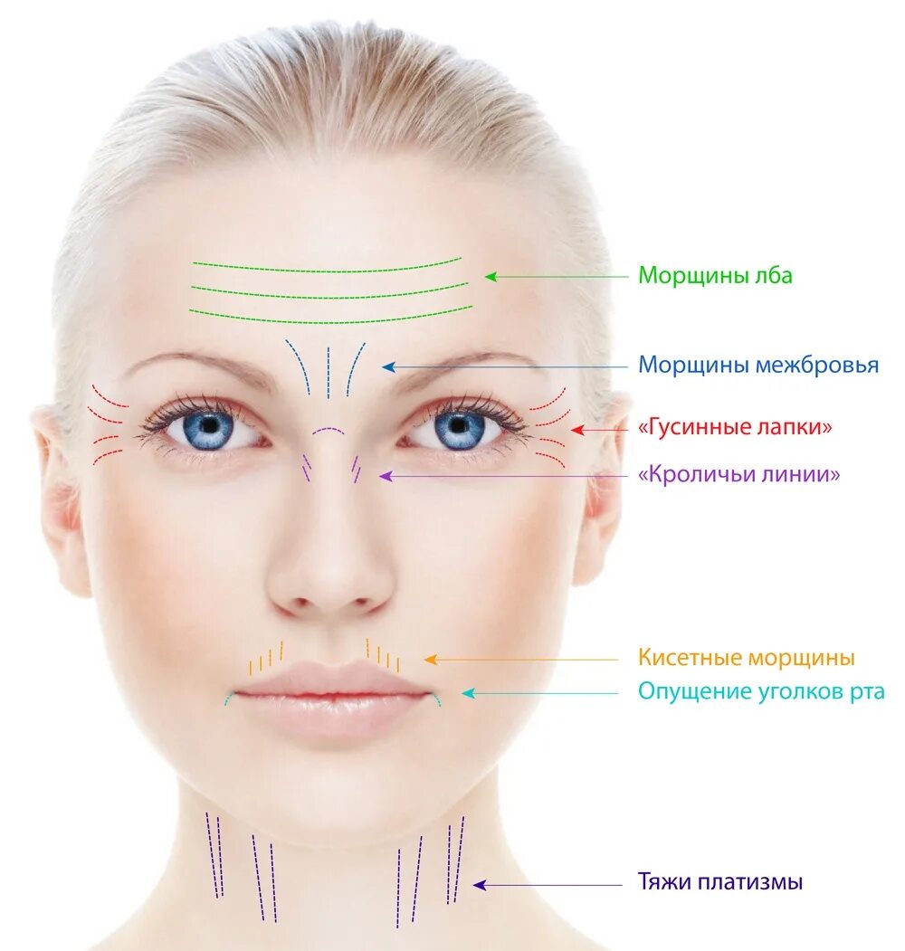 Косметология мышцы. Мимические морщины. Мимические морщины на лице. Название морщин.