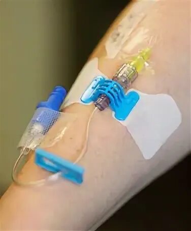 Intravenous не запускается. Intravenous 2 арт.