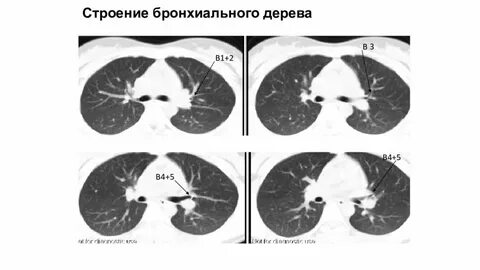 Кт 91
