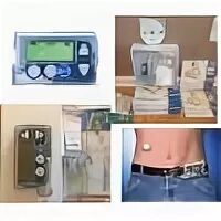 Инструкция инсулиновой помпы