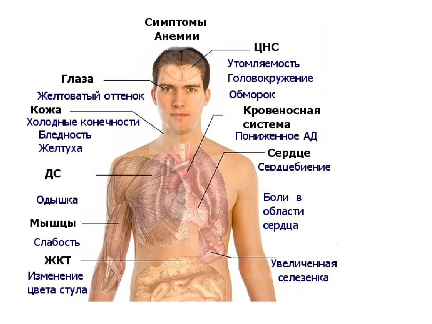 Витамин в12 дефицитная анемия симптомы. Симптомы б 12