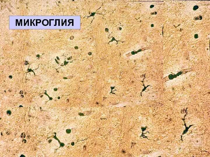 Микроглия. Микроглия гистогенез. микроглия гистология. микроглия препарат. микроглия фото.