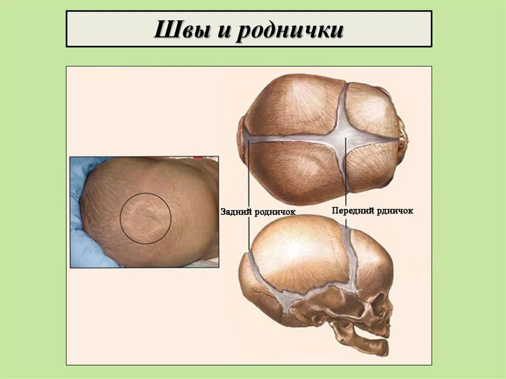 Родничок на головке. Родничок на голове у новорожденных. Строение головки плода швы роднички. Темечко на голове у младенца. Строение черепа новорожденного швы роднички.