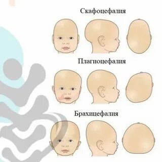 Головка малыша