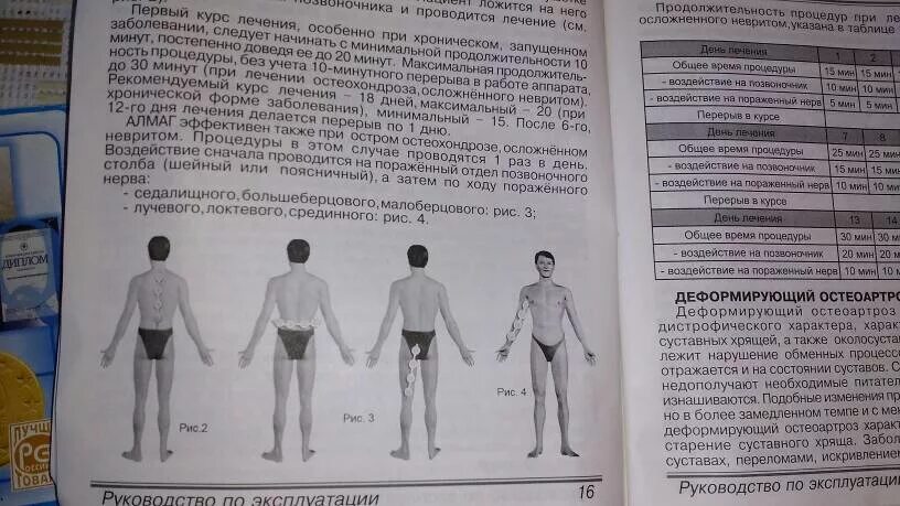 Алмаг 01 инструкция цена. Схема наложения прибора алмаг-01. Алмаг инструкция. Алмаг-01 руководство по эксплуатации. Схема пользования алмаг 01.