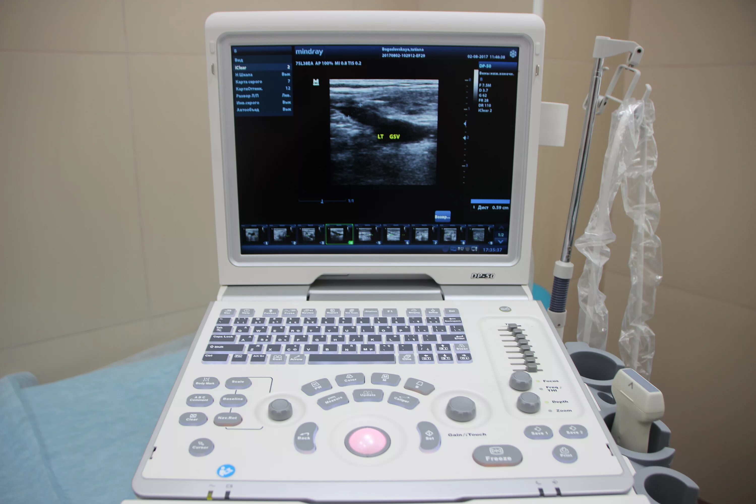 Кардиоцентр центр нижний новгород. Дзержинск поликлиника юна профосмотр. Узи на семашко. Кабинет узи борисенко ейск. Ачинский перинатальный центр.