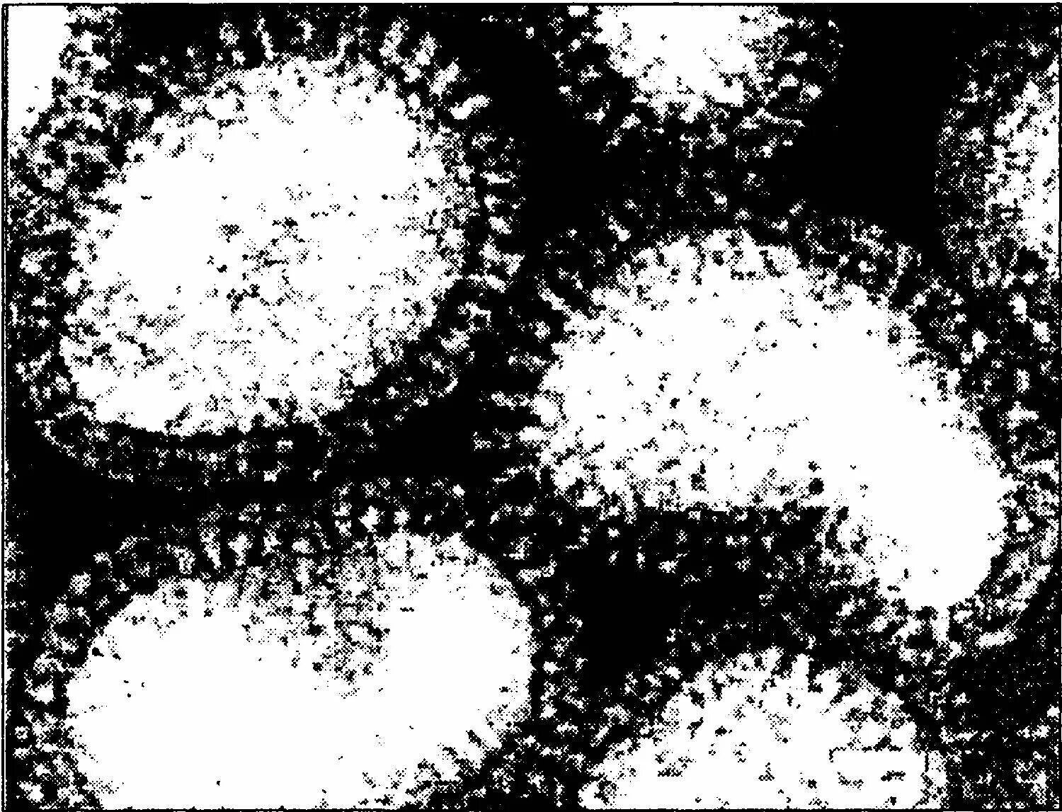 Вирус гриппа микрофотография. Электронная микрофотография вируса гриппа а. Вирус гриппа под микроскопом h1n1. Электронные микрофотографии вирусов. Вирус гриппа группа