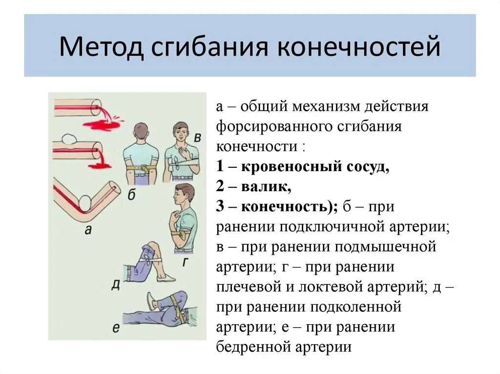 Остановка кровотечения путем сгибания конечности. Способы остановки кровотечений на конечностях. Остановка кровотечения способом сгибания конечности. Максимальное сгибание конечности для остановки кровотечения. Предельное сгибание конечности в суставе.