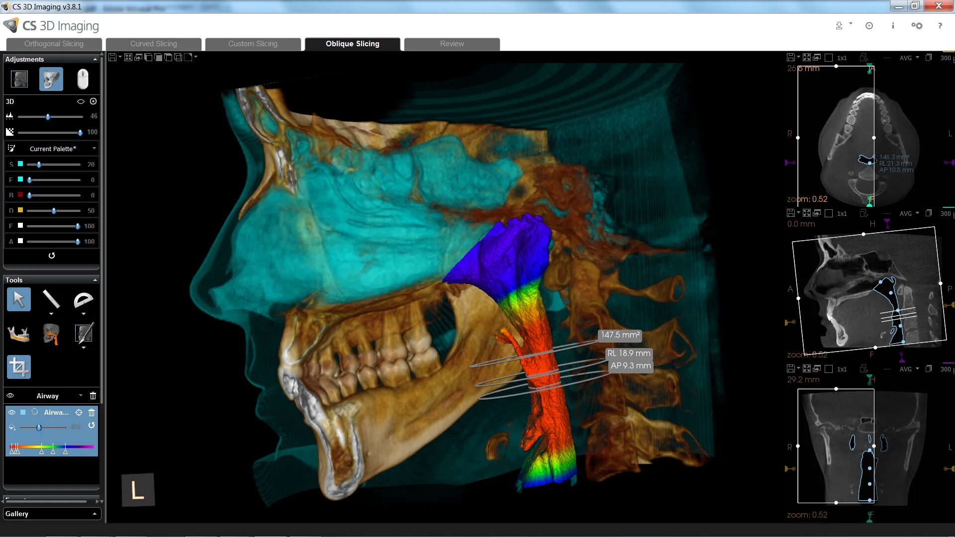 Cs imaging. Cs imaging