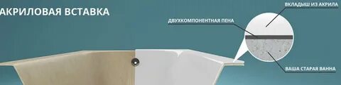 Установка акрилового вкладыша