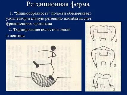 Полость формы