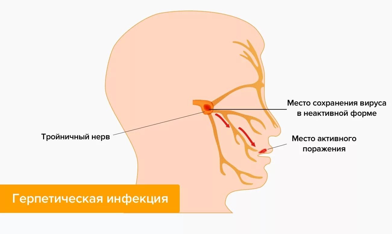 Патология тройничного нерва симптомы. Воспаление тройничного лицевого. Невралгия тройничного нерва. Тройничный нерв на лице симптомы.
