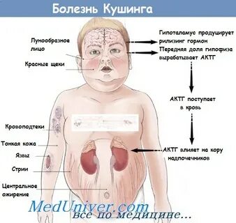Рак надпочечников симптомы признаки у женщин