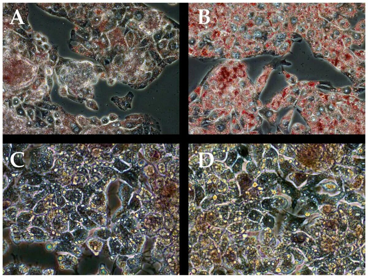 Клетки печени разрушаются. Клетки печени. Хондриосомы в клетках печени. Стволовые клетки печени мыши.