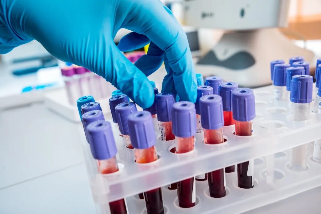 Взятие крови у кошек и собак. Взятие крови у кошек и собак. Биохимия ветеринария. Ветеринар с собакой. Исследование крови в лаборатории.