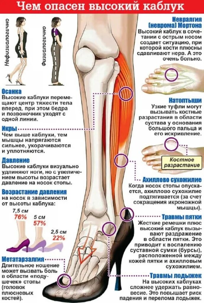 Сильно болят суставы ног. Кость на ноге от высоких каблуков. Косточки на стопе от высоких каблуков.
