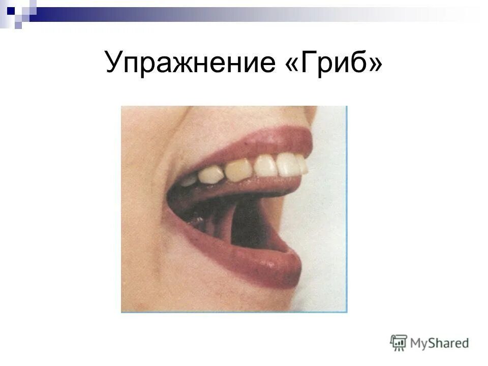 Артикуляционная гимнастика грибок. Артикуляционные упражнения гр бок. Артикуляционная гимнастика грибок. Артикуляционная гимнастика для детей грибок. Артикуляционная гимнастика грибок в картинках.